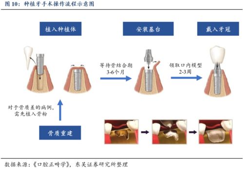 正海生物深度报告 深耕再生医学领域近20年,储备产品线丰富