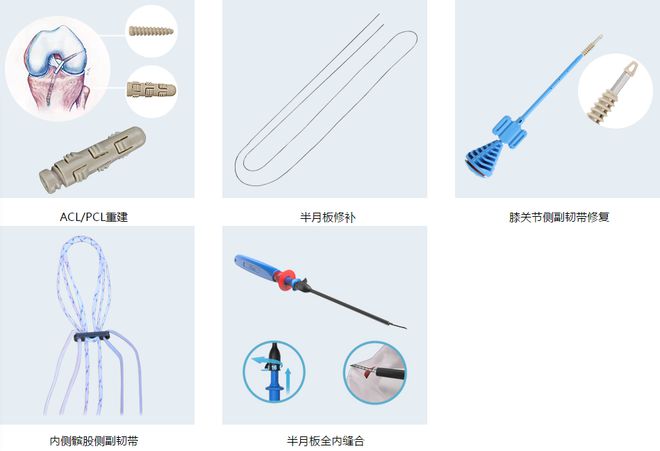 国产运动医学龙头 技术突破与市场前景分析